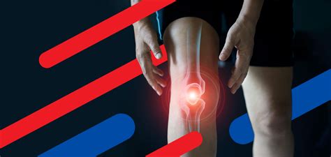 Причины беспричинной боли в коленном суставе